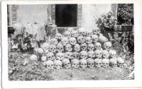 Bone11