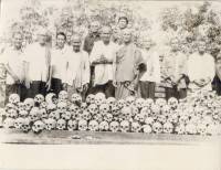Bone27