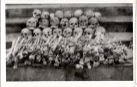 Bone34